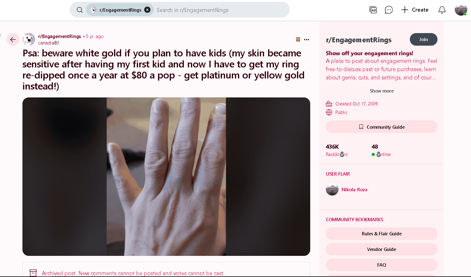 White gold causes skin rashes in people with metal sensitivities
