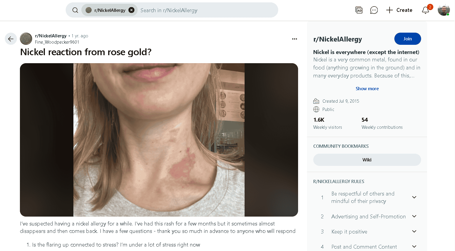 Does Rose Gold Contain Nickel? Does Rose Gold Contain Nickel?