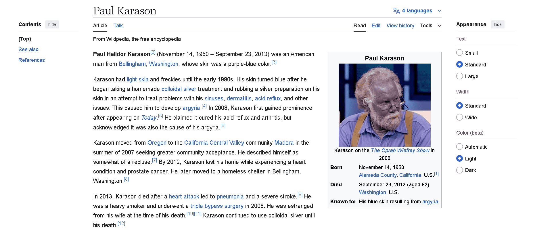 An example of a man stricken with argyria gotten from prolonged colloidal silver usage. An example of a man stricken with argyria gotten from prolonged colloidal silver usage.