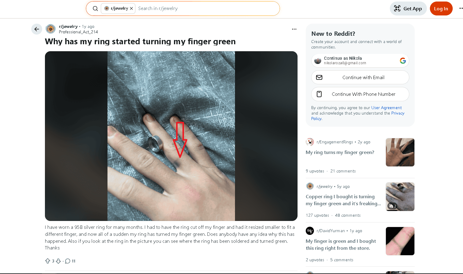 Sterling silver turned a finger green example 1 Sterling silver turned a finger green example 1