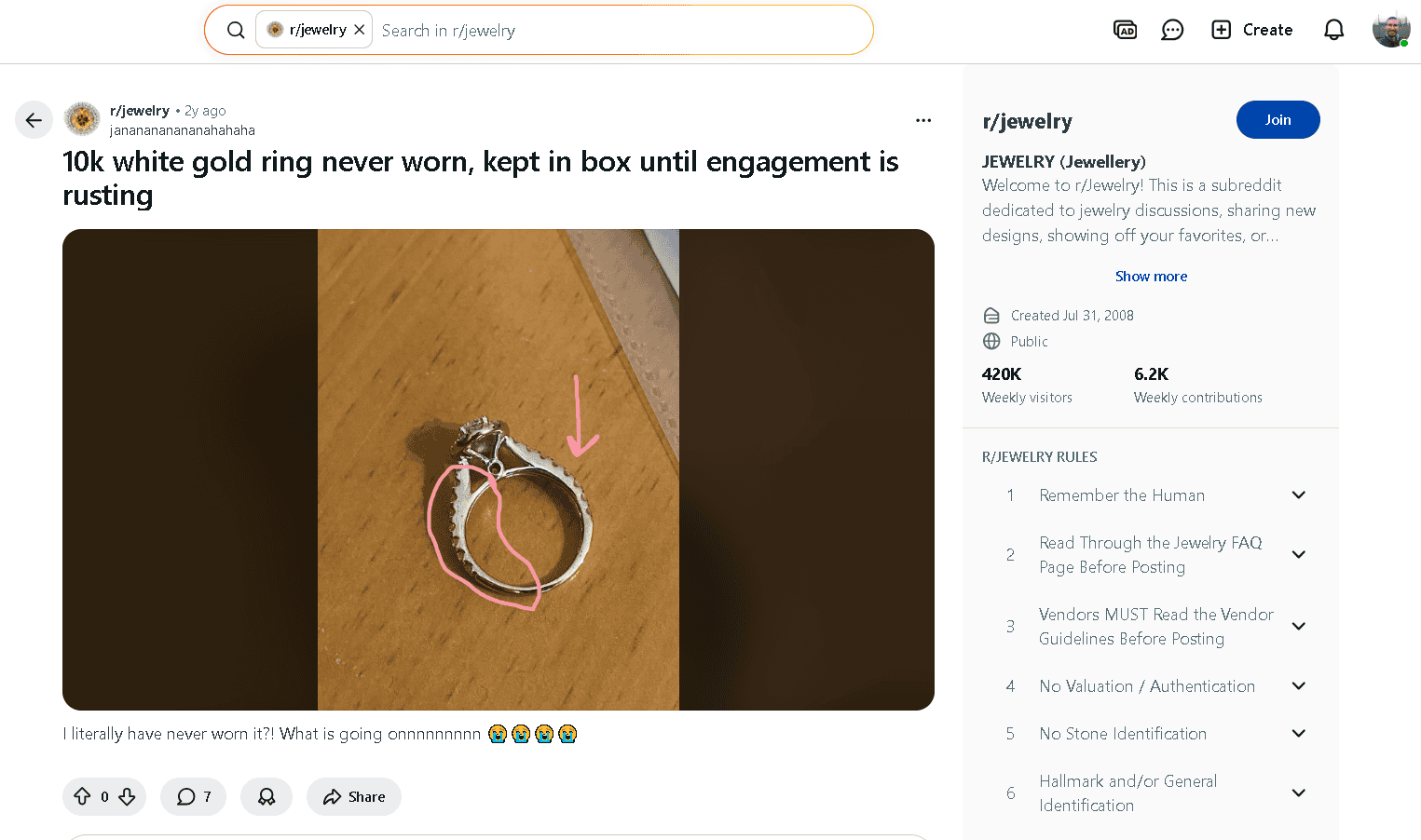 An example of a 10k white gold discolored (tarnished) ring
