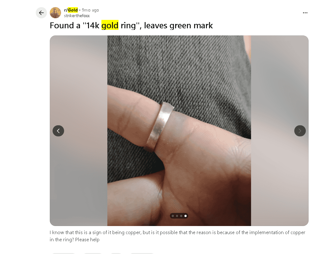 Example of fake 14k gold ring that discolored human skin green Example of fake 14k gold ring that discolored human skin green