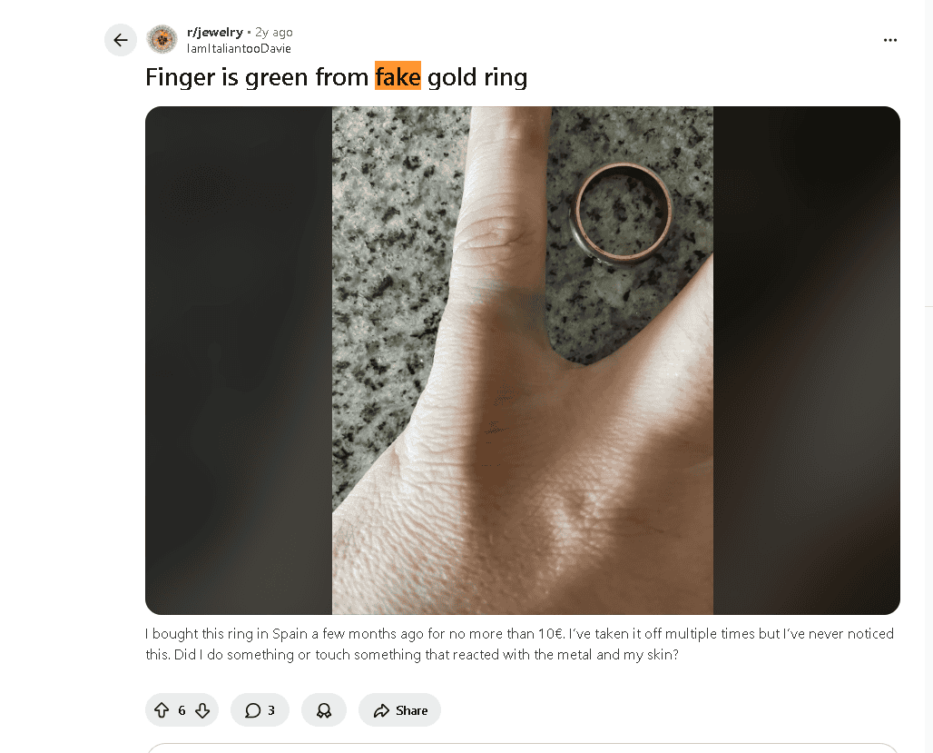 Fake gold ring turned this finger green (example) Fake gold ring turned this finger green (example)