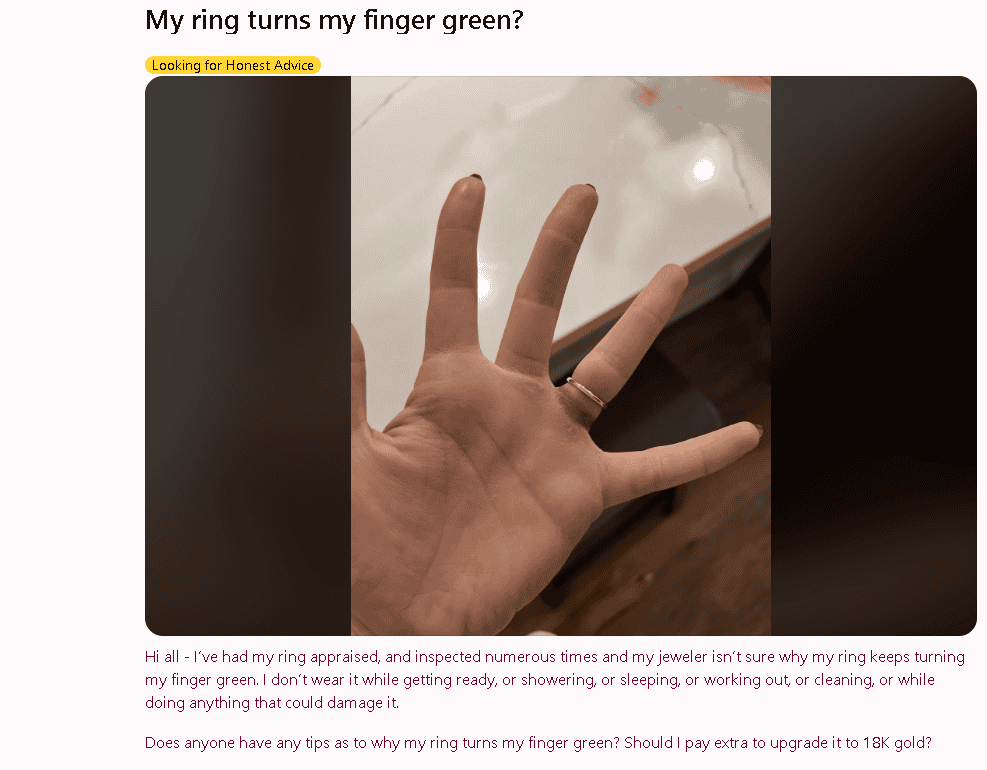 Gold ring turns human skin green example Gold ring turns human skin green example
